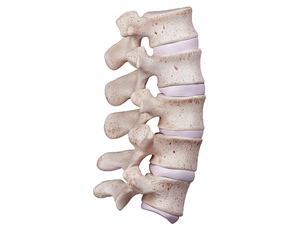 척추 치료 한눈에 보기